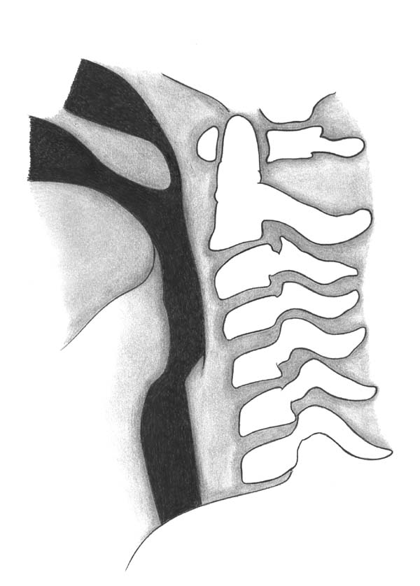 Pediatric Radiology Normal Measurements OHSU